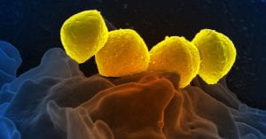 Scanning electron micrograph of Streptococcus A (yellow balls) attached to a human neutrophil (spiky blue surface)
